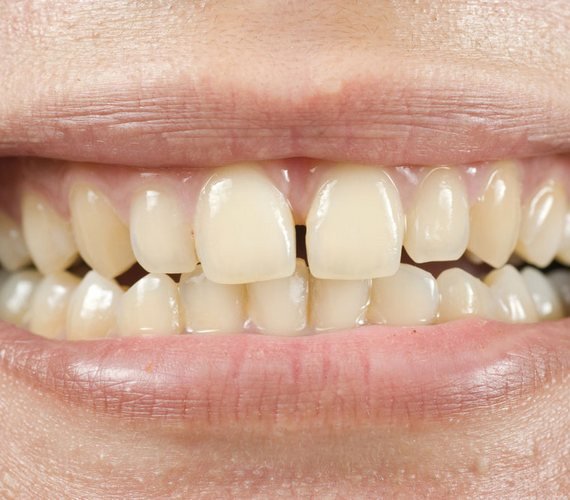 Menselijke tanden